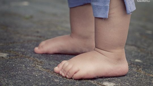 Opuchnięta noga może doprowadzić do śmierci?