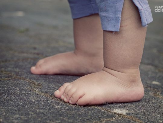 Opuchnięta noga może doprowadzić do śmierci?