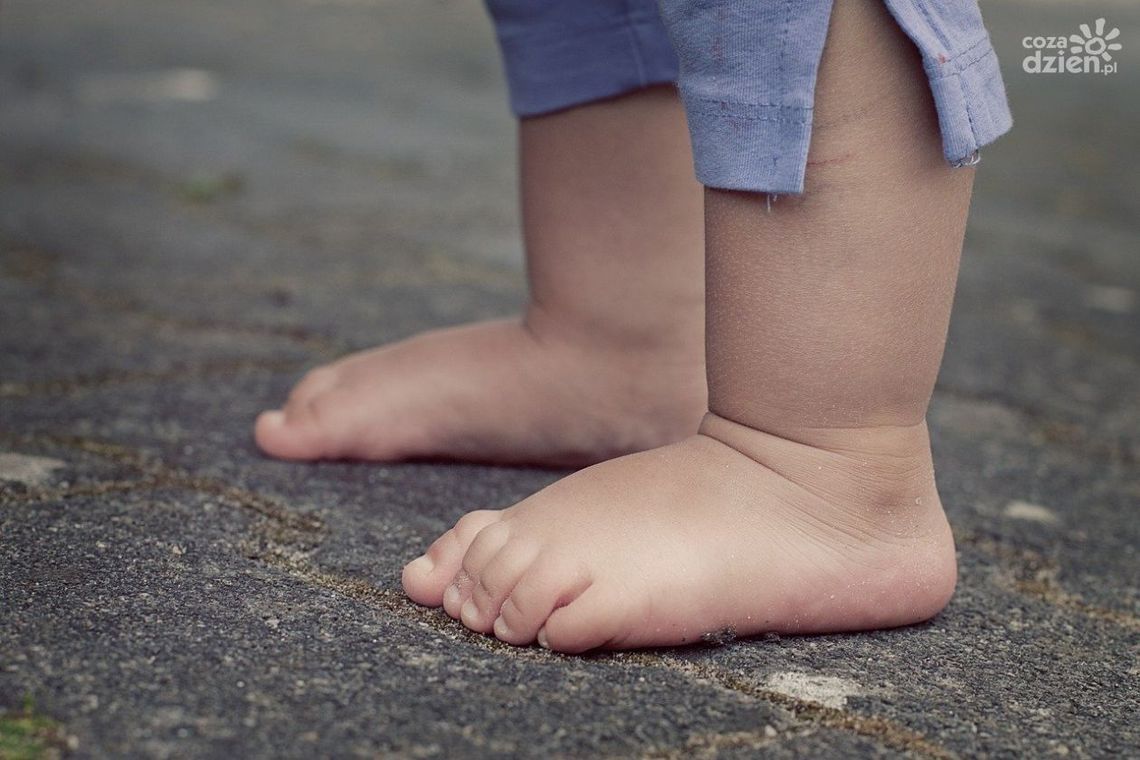 Opuchnięta noga może doprowadzić do śmierci?